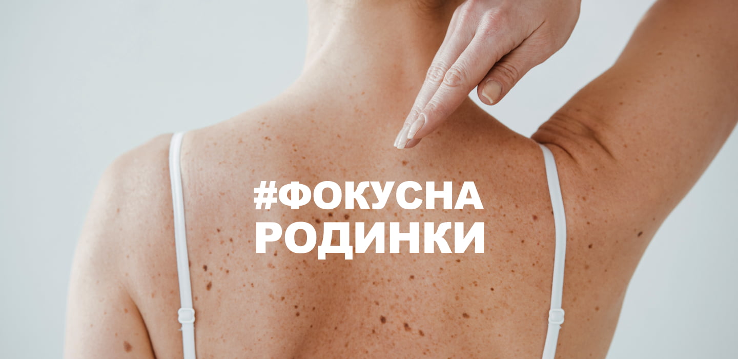 checkyourskin